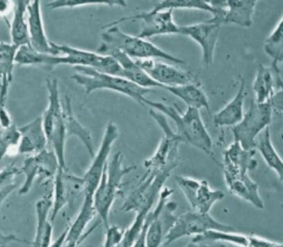 人肾小球系膜细胞,Human glomerular mesangial cells