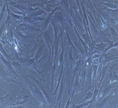 人膀胱平滑肌细胞,Human bladder smooth muscle cells