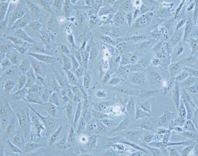 人心肌细胞,Human cardiomyocyte