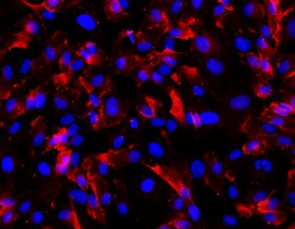 人脐静脉内皮细胞,Human umbilical vein endothelial cells