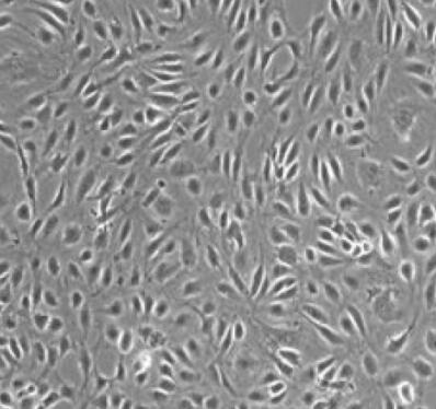 人腹膜毛细血管内皮细胞,Human peritoneal capillary endothelial cells