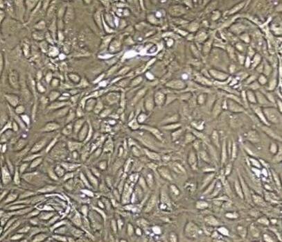 人髂动脉内皮细胞,Endothelial cells of human iliac artery