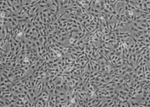 人大隱靜脈內(nèi)皮細胞,Endothelial cells of great saphenous vein