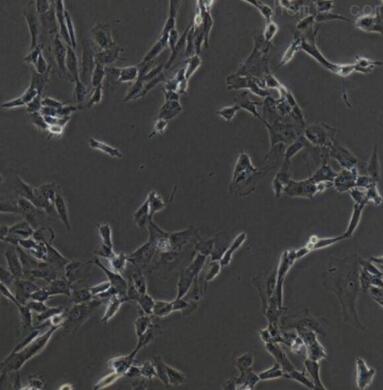 人滑膜细胞,Human synovial cells