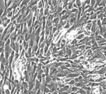 人骨骼肌細胞,Human skeletal muscle cells