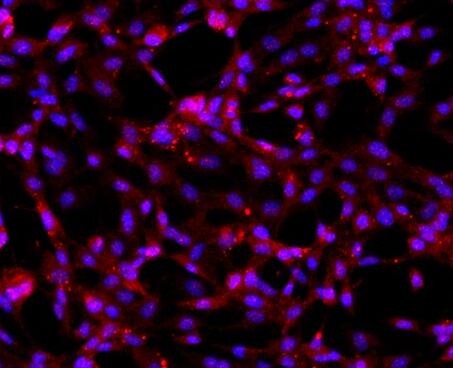 人关节软骨细胞,Human articular chondrocyte