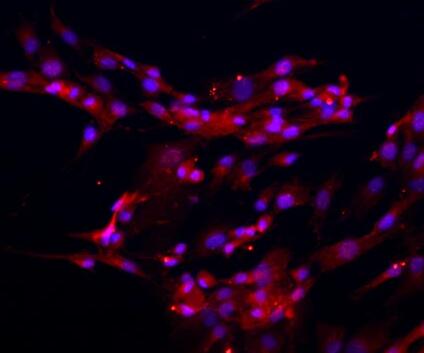 人椎间盘髓核细胞,Human intervertebral disc nucleus pulposus cells