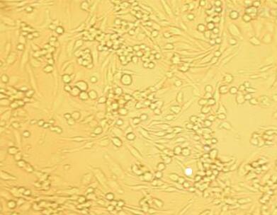 人表皮角化细胞,Human epidermal keratinocytes