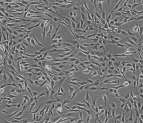 人真皮成纤维细胞,Human Dermal Fibroblasts-adult