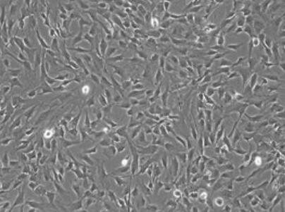 人腦動脈血管內(nèi)皮細胞,Human cerebral artery endothelial cells