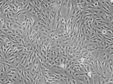 人腦靜脈血管內(nèi)皮細(xì)胞,Human cerebral vein endothelial cells