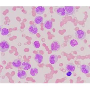 人外周血白细胞,Human peripheral blood leukocytes