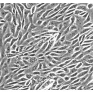 人食管上皮细胞,Human esophageal epithelial cells