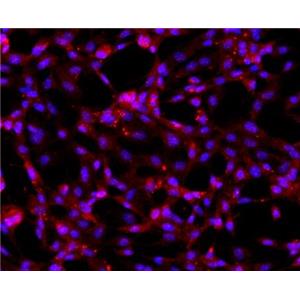 人關(guān)節(jié)軟骨細(xì)胞,Human articular chondrocyte