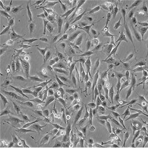 人真皮淋巴上皮细胞,Human dermal lymphoepithelial cells