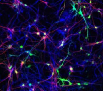 人神经星形胶质细胞,Human neuroastrocytes