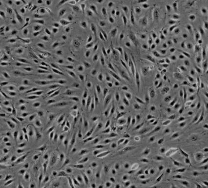 人腦微血管內(nèi)皮細(xì)胞,Human brain microvascular endothelial cells