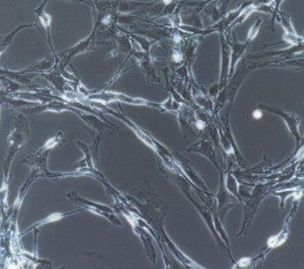 人视网膜微血管内皮细胞,Human retinal microvascular endothelial cells