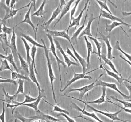 人小梁網(wǎng)細胞,Human trabecular meshwork cells