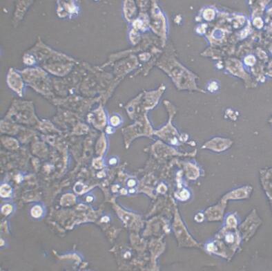 人視網(wǎng)膜Muller細(xì)胞,Muller cells of human retina