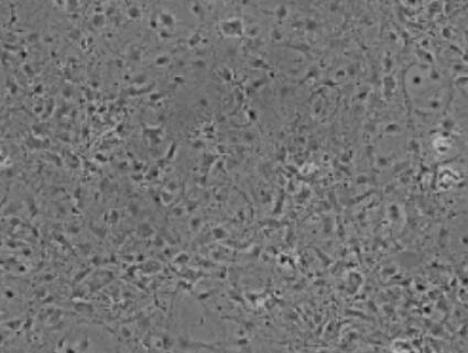 人肺癌组织源细胞,Human lung cancer tissue derived cells