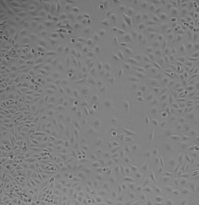 人胶质瘤组织源细胞,Human glioma tissue derived cells