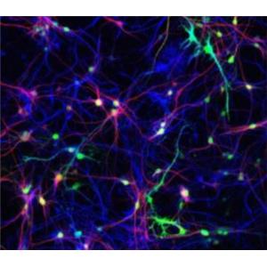 人神经星形胶质细胞