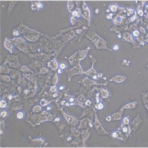 人视网膜Muller细胞,Muller cells of human retina