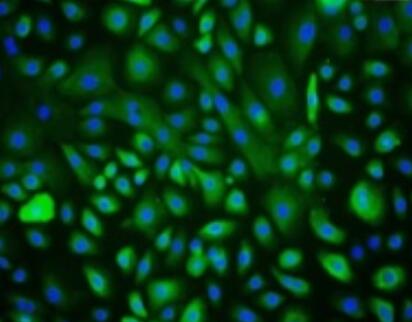人胃癌组织源成纤维细胞,Human gastric cancer tissue derived fibroblasts