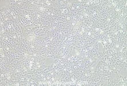 人髓母細胞瘤組織源細胞,Human medulloblastoma tissue derived cells