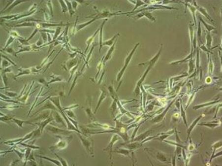 人胚肺成纖維細(xì)胞,Human embryonic lung fibroblasts