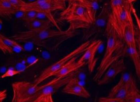 人骨髓來源內(nèi)皮祖細(xì)胞,Human bone marrow derived endothelial progenitor cells