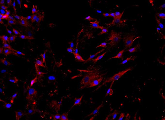 人骨髓间充质干细胞,Human bone marrow mesenchymal stem cells