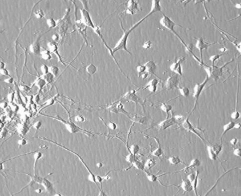 人肝外胆管上皮细胞,Epithelial cells of human extrahepatic bile duct