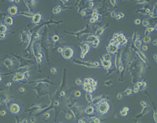 人外周血树突状细胞(成熟DC细胞),Human peripheral blood dendritic cells