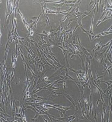 人脐带血来源内皮祖细胞,Endothelial progenitor cells derived from human umbilical cord blood