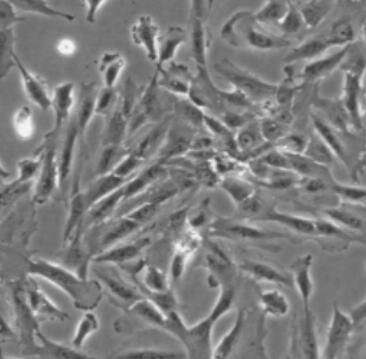 人外周血单核细胞,Human peripheral blood monocytes