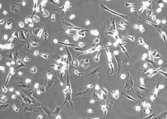 人骨髓单核细胞,Human bone marrow mononuclear cells