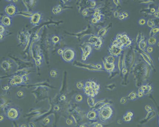 人骨髓树突状细胞(成熟DC细胞),Human bone marrow dendritic cells