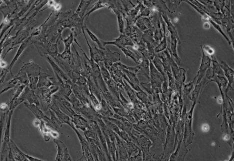 人卵巢颗粒细胞,Human ovarian granulosa cells