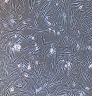 人胎盤間充質(zhì)干細胞,Human placental mesenchymal stem cells