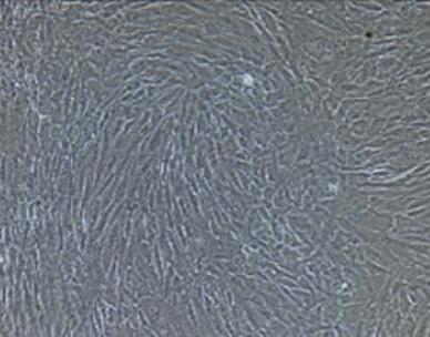 人胃癌组织成纤维细胞,Human gastric cancer tissue fibroblasts