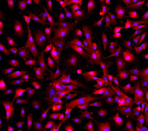 小鼠肺微血管内皮细胞,Mouse pulmonary microvascular endothelial cells