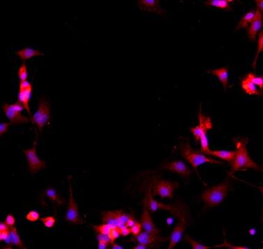 小鼠Ⅱ型肺泡上皮细胞,Mouse type II alveolar epithelial cells
