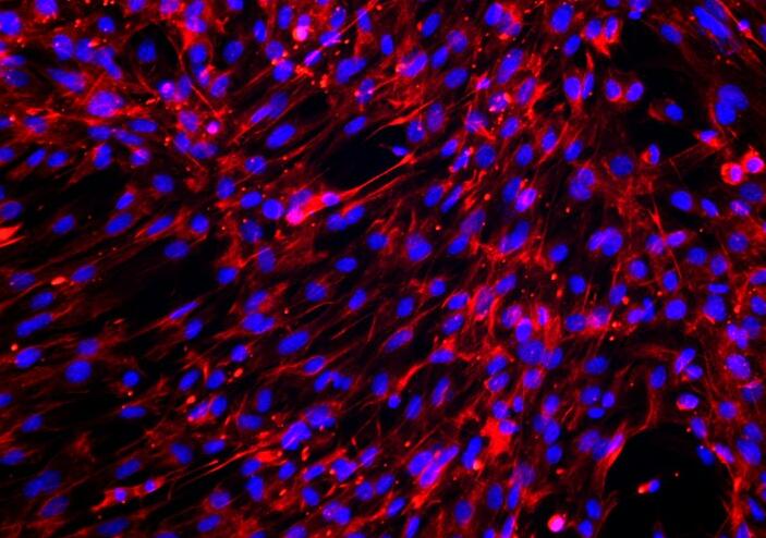 小鼠肺成纤维细胞,Mouse lung fibroblasts