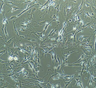 小鼠肺大静脉平滑肌细胞,Smooth muscle cells of mouse pulmonary vein