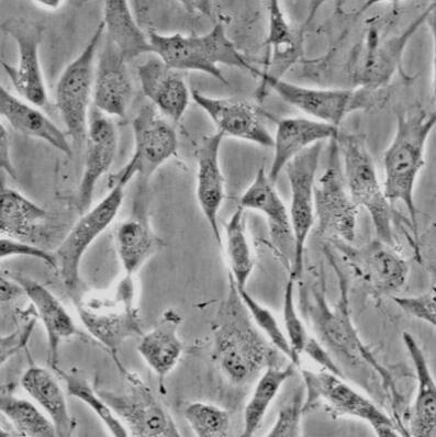 小鼠肺大动脉平滑肌细胞,Smooth muscle cells of mouse pulmonary artery