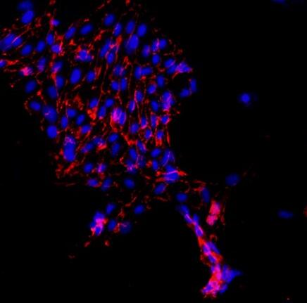 小鼠肺大动脉内皮细胞,Mouse pulmonary artery endothelial cells