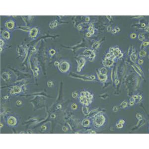 人骨髓树突状细胞(成熟DC细胞),Human bone marrow dendritic cells