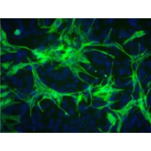 人血管外膜成纤维细胞,Human adventitia fibroblasts